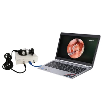 Medicinske CMOS prenosni usb endoskopijo endoskop HD kamera za ENT